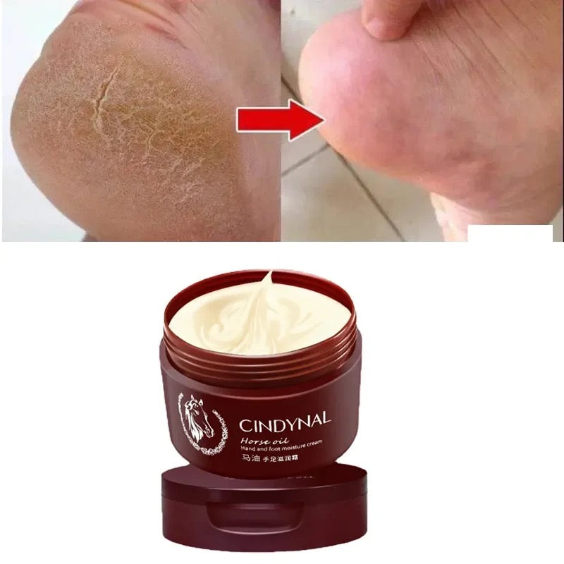 Horse Oil Hand and Foot Cream Anti-Cracking Cream Hydrating Whitening